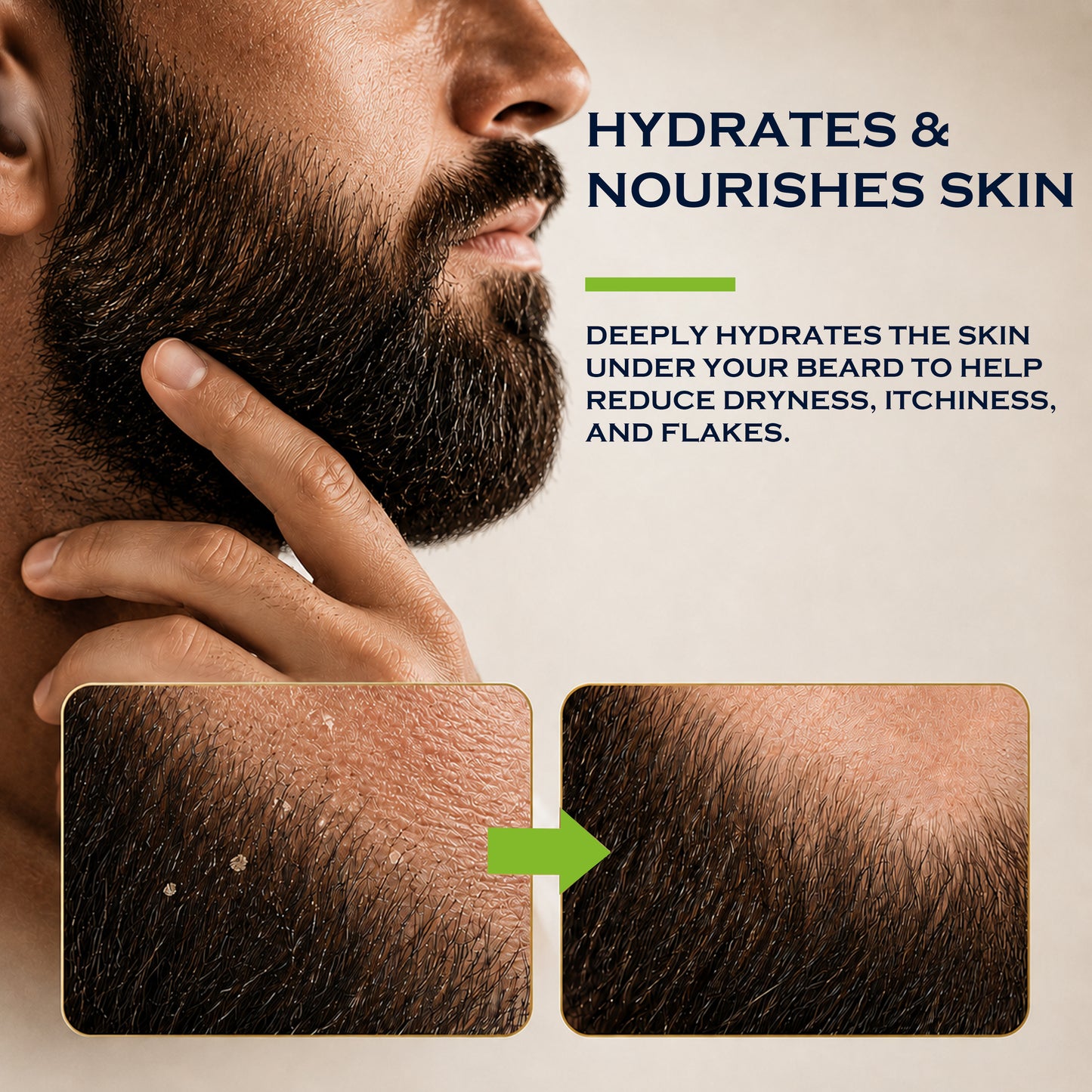 Beard Oil - Cedar
